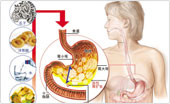 六安胃肠医院治疗急性胃扩张